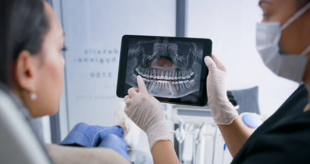 Licensed Dental Veneers service in Longview, TX - Smile Center Dentistry